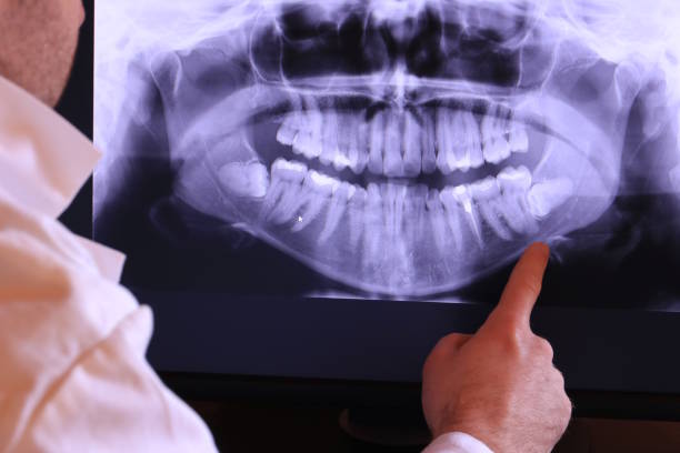 Best Emergency Broken Tooth Repair in Topton, PA