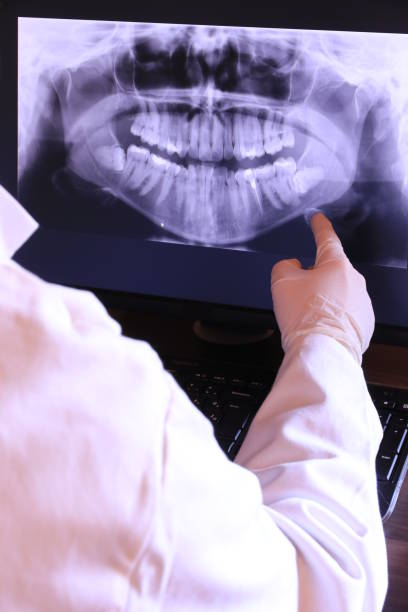 Best Emergency Tooth Extraction in Topton, PA